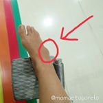 Fratura do quinto metatarso.
Hora de botar as crianças  na cama, subi no colchão da Mia para fechar a janela do quarto, quando desci torci o pé de uma certa forma que os ligamentos puxaram o pedacinho do osso e fraturou. Não sabia na hora o que tinha acontecido exatamente, mas sabia que tinha ouvido um estalo alto, que doía pra cacete, que não conseguia colocar meu pé no chão e que estava muito inchado.
Isso que vocês estão vendo na foto é o inchaço, não é o maléolo lateral!! Indo pro hospital eu só pensava nas crianças. Antes de ir ainda amamentei a Mia, pois se eu precisasse de cirurgia e dependendo dos remédios que passassem ou do tempo que eu ficasse internada, poderia ser a última vez ela tomaria o Tetê da mamãe.
Também fiquei preocupada pensando quem cuidaria dos dois. 
Mas por outro lado fiquei super feliz de saber que estamos morando onde tem um dos melhores hospitais da Europa. Estou impressionada com o atendimento.
Essa é a história do que aconteceu, para quem estava perguntando.
Mas que vergonha que dá de contar que quebrei o pé descendo da cama da Mia.
.
.
.
.
.
#maecansada #gesso #imobilizada #fratura #pequebrado #dor #maesofre #coisademae #amordemae #sofrimento #eagora #mamaedeprimeiraviagem #maebabona #maecoruja  #maedeprimeiraviagem #maededois #maedecasal #maecasal👫 #maedemenino #maedemenina #maternidadereal #maternidadenuaecrua #vipinstabloggers  #MaesQuelnteragem #maequesevira #daumjeito  #sevira #maequecuida #pataquebrada