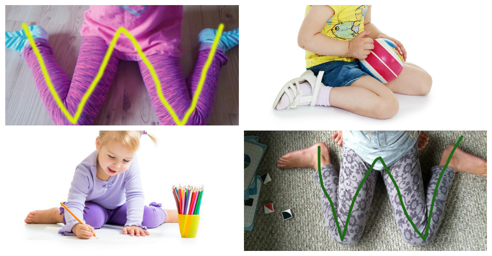 Crianças sentadas na posição W e seus perigos