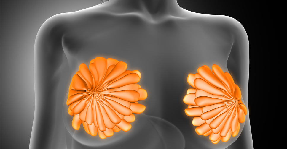 Empedramento (Ingurgitamento Mamário) – Guia Rápido de Cuidados