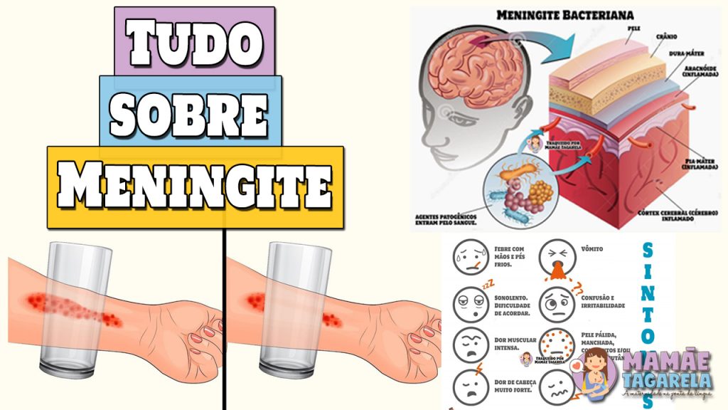 meningite sintomas de meningite vacinas de meningite como evitar pegar meningite