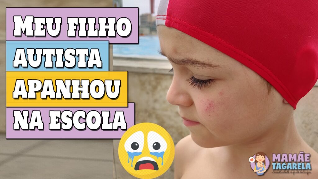 Eric com o rosto machucado quando apanhou na escola.